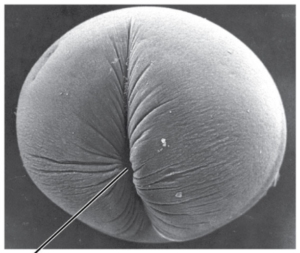 <p>The pinching in of the cell membrane in an animal cell after mitosis of the nucleus. Involves the formation of a cell plate in plant cells.</p>