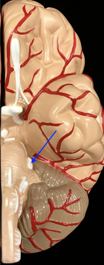 <p>What is the cranial nerve and roman numeral?</p>