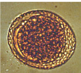 <p>Tell me about the Dog roundworm, main name?DH?  Pathogenesis? clinical signs? Diagnosis? Treatment and prevention? Zoonoses? </p>