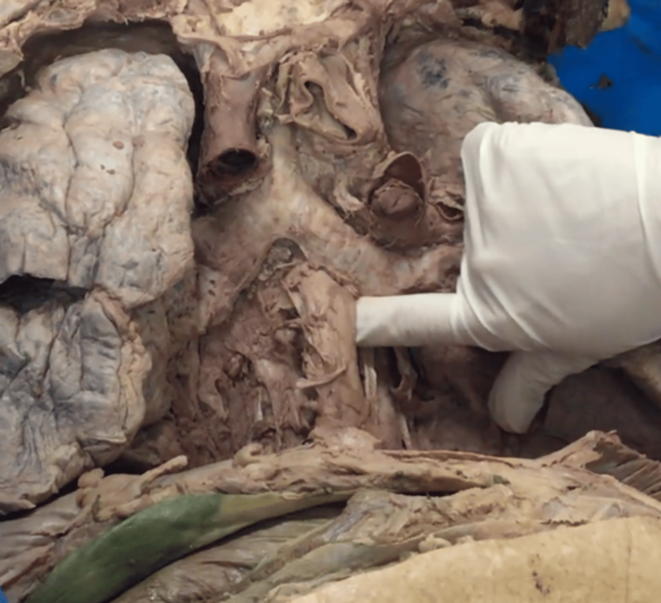 <p>begins at laryngopharyanx passes through diaphragm and connects to the stomach. Sits medially to thoracic aorta and posterior to the trachea in the posterior mediastinum.</p>