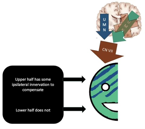<p>unilateral innervation = when one side of the brain controls one side of the body</p><p>(usually contralateral hemisphere of brain controls the opposite part of body)</p><p>BUT usually gets compensated by the unaffected side of the brain except for CNs controlling lower half of face </p><p>often UNDERDIAGNOSED because signs do not usually show with compensation from other side of brain; perceptual characteristics are not well-defined </p><p>frequently co-occurs with aphasia, apraxia of speech (planning of speech) </p>