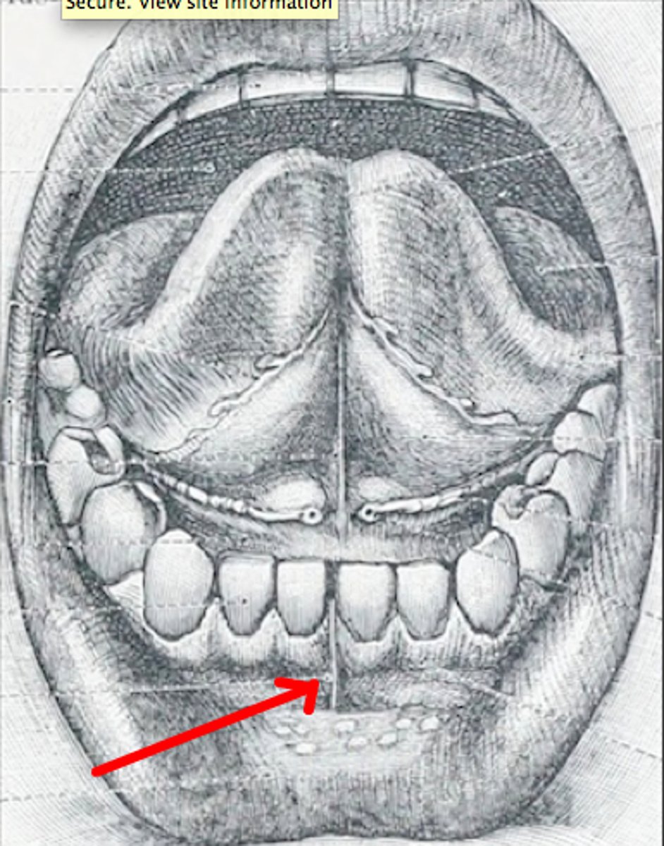 <p>Identify this structure.</p>