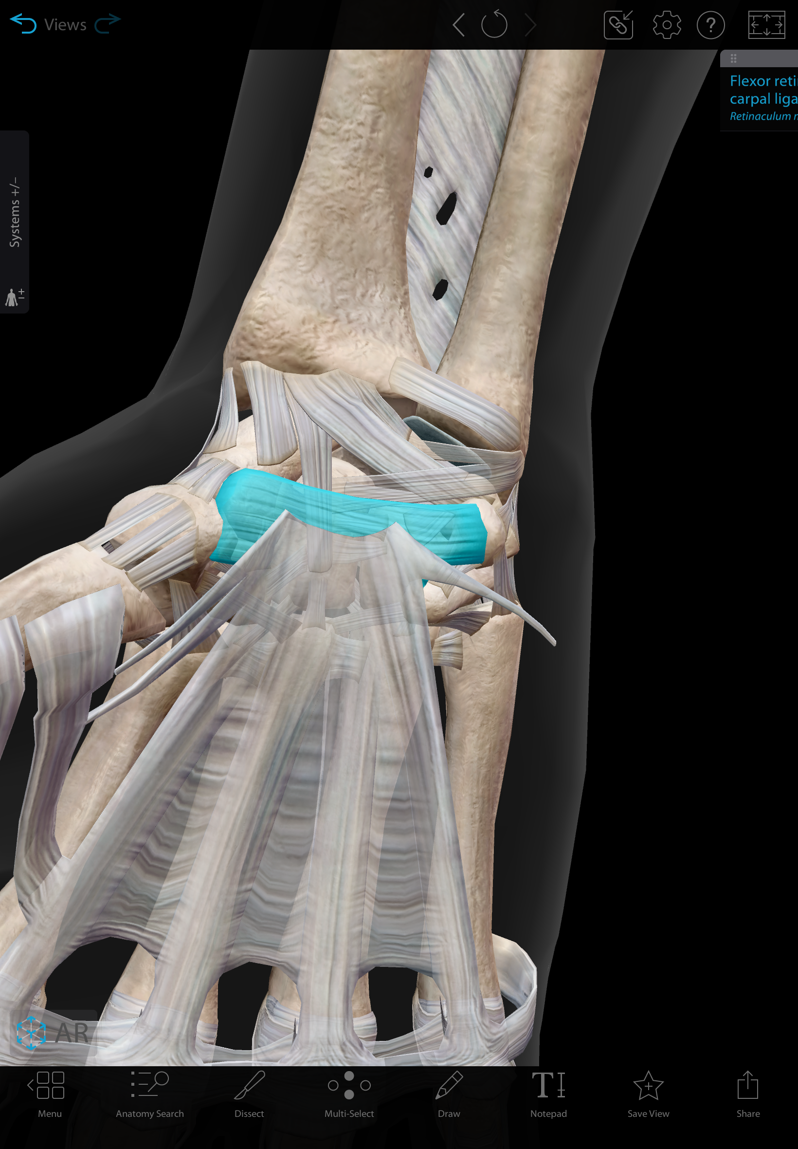 <p>Flexor retinaculum</p><p>Connective tissue sheet connecting the distal forearm to the palm. Attaches to the pisiform and hook of the hamate on the medial side and the scaphoid and trapezium on the lateral side.</p>