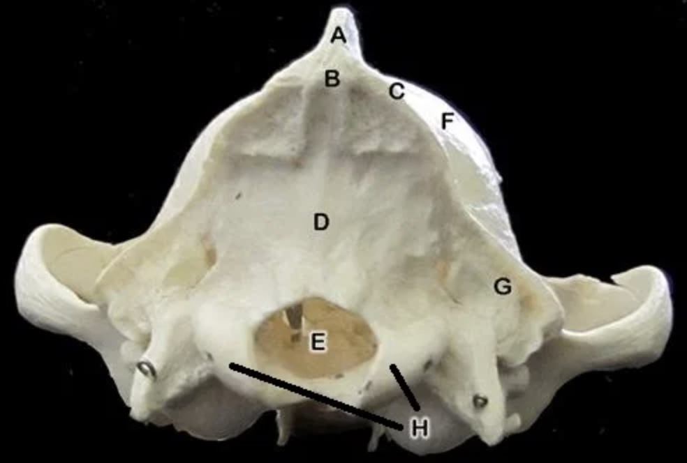 <p>Structure A is known as the ____.</p>