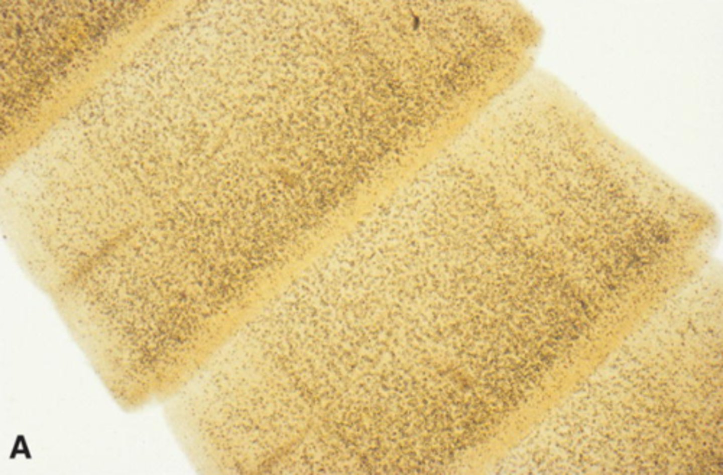 <p>What parasite is this if it is from a cat</p>