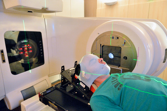 <p>la radiothérapie</p>