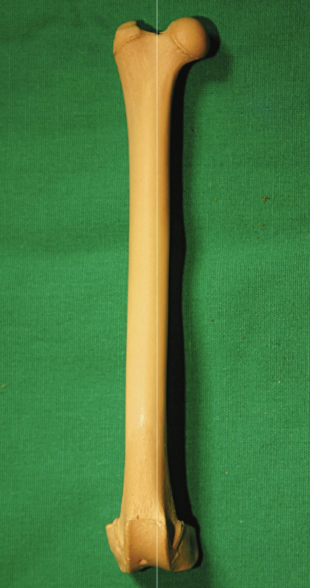 <p>Shape?</p>