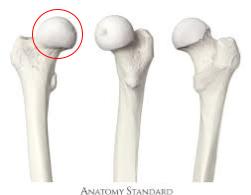 <p>Proximal end of femur, articulates with acetabulum</p>