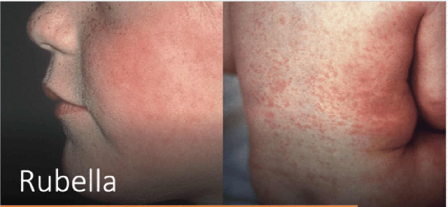 <p>Rubella virus</p>