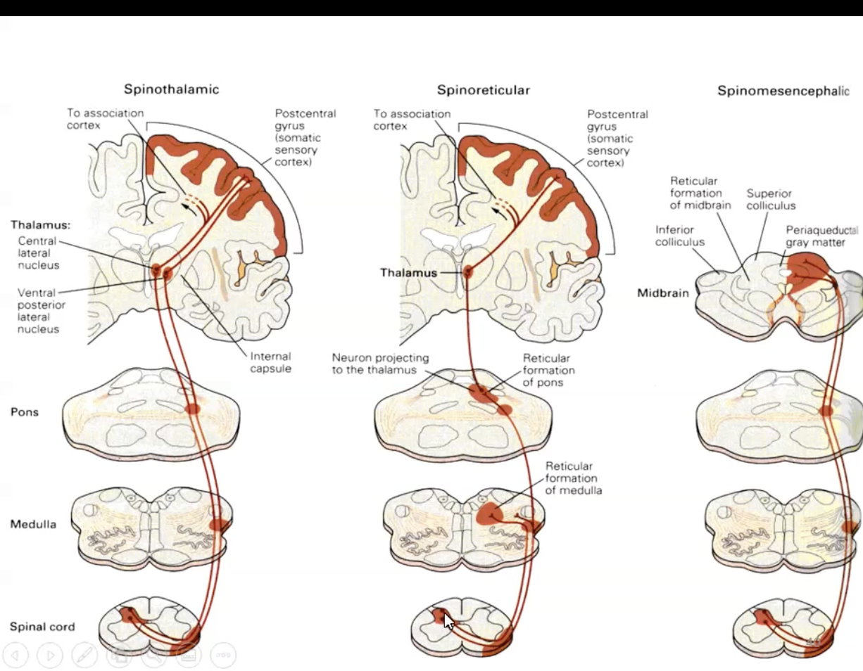 <ul><li><p>First order neurons in spinal nerves synapse on to second order neurons in the dorsal gray horn which decussate to the contralateral side </p></li><li><p>Second order neurons run up to the mesencephalic (midbrain) reticular formation and periaquaductal gray matter </p></li><li><p>These then connect to limbic system e.g. amygdala </p></li><li><p>Responsible for affective responses to pain</p></li></ul><p></p>