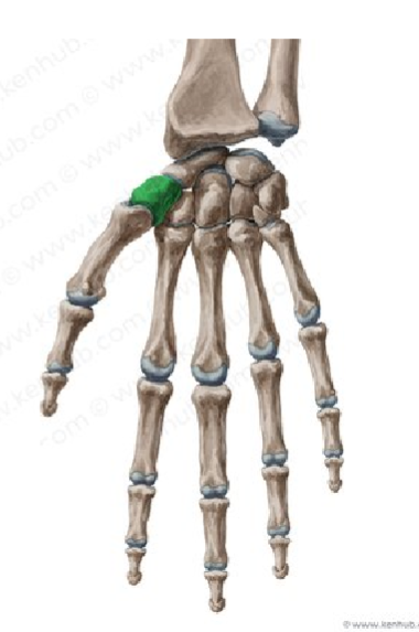 <p>Carpometacarpal Joint </p>