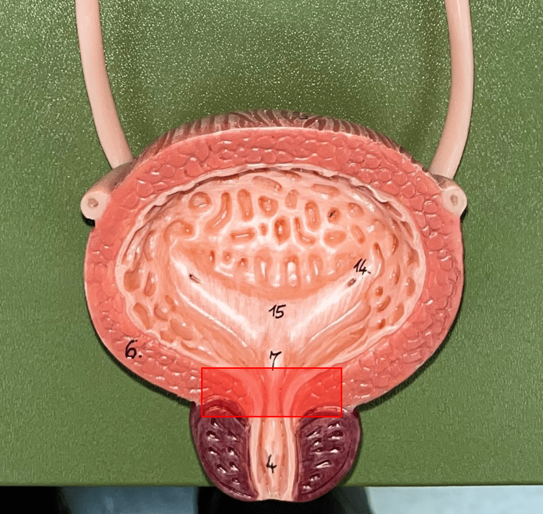 \
• Part of the urethra.

• A circular layer of circular smooth muscle located just after the internal urethral orifice.

• Involuntary muscle allowing urine to flow outward.
