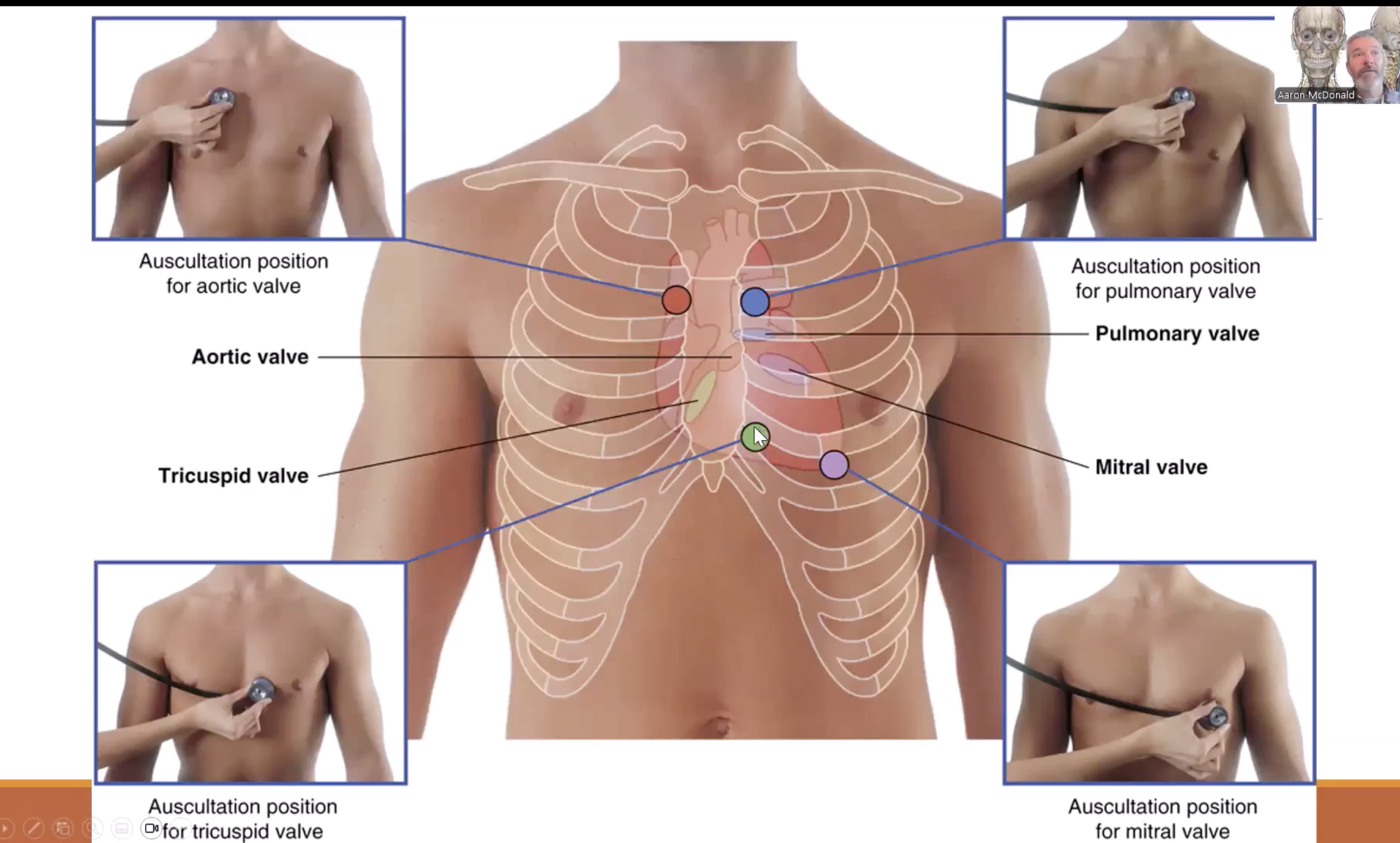<p>Auscultation:</p><ul><li><p>To hear the heart with a stethoscope</p></li></ul><p><strong><em><u>Heartbeat: </u></em></strong></p><ul><li><p>Sound is created when blood rushes against closed valves</p></li><li><p>Ensures valves are working accordingly and blood is rushing in the correct direction</p></li></ul><p></p>