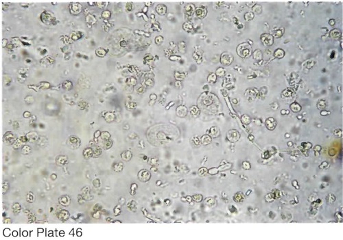 <p>B. The major formed elements are white</p><p>blood cells and yeast.</p>