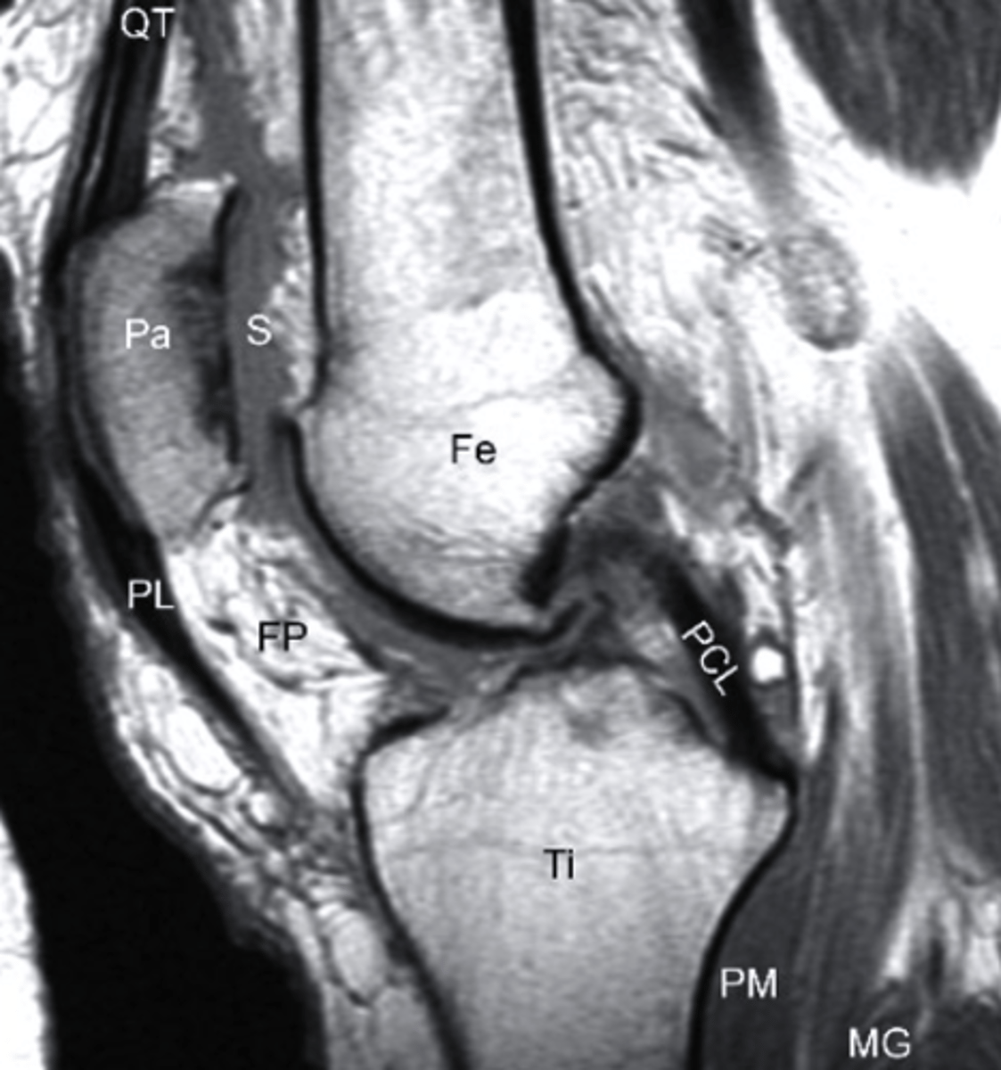 <p>what type of image is this?</p><p>a. T2 MRI</p><p>b. CT Scan</p><p>c. T1 MRI</p><p>d. conventional radiograph</p>