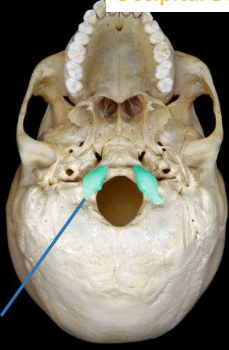 <p>sits on the atlas (bumps above the foramen Magnum)</p>