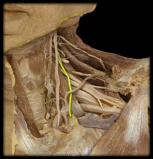 <p>What plexus is this</p>