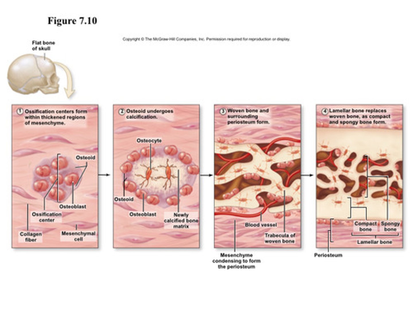 <p>1. Cells in the mesenchyme (the common connective tissue layer) come together and develop into osteoprogenitor cells and then into osteoblasts.</p><p>This is the center of ossification. The osteoblasts secrete the organic matrix of the bone until they are completely surrounded by it</p><p>2. As the osteoblasts become surrounded by a hard matrix, they form trabeculae which fuse with each other to form the lattice structure of</p><p>spongy bone.</p><p>3. The internal spaces fill with red bone marrow.</p><p>On the outside of the bone, the mesenchyme condenses and eventually becomes the periosteum.</p><p>4. The surface of the bone is eventually reconstructed into compact bone</p>