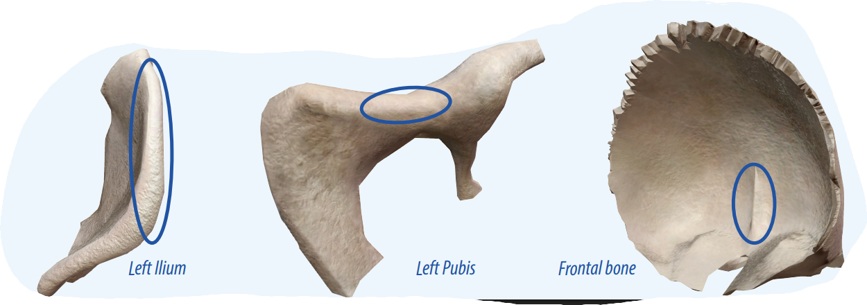 <p>A raised ridge projection that is part of the edge of a bone and allows connective tissues to connect to the bone.</p>