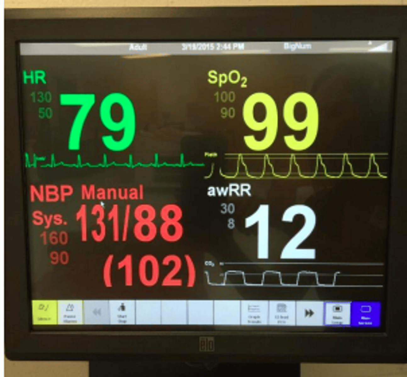 <p>Includes blood pressure, heart rate/cardiac patterns, temperature, respiration rate, oxygen saturation</p>