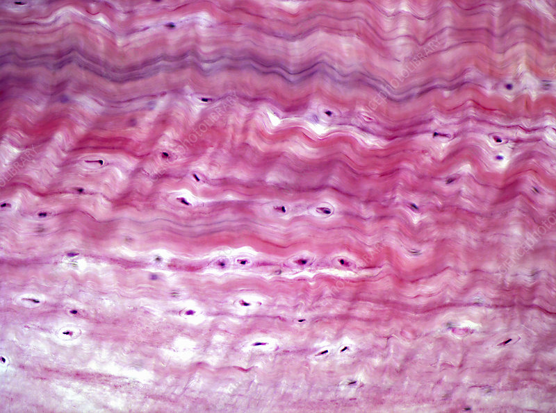 <p><strong>What is a picture example of fibrocartilage tissue?</strong></p>
