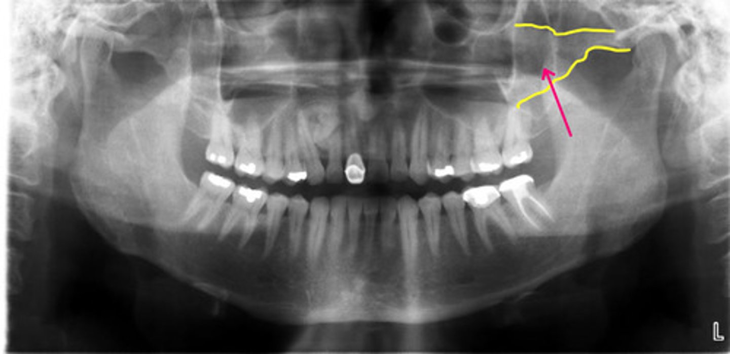 <p>Identify the structure.</p>