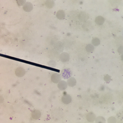 <p>Under UV light, what is the other name of this cell?</p>