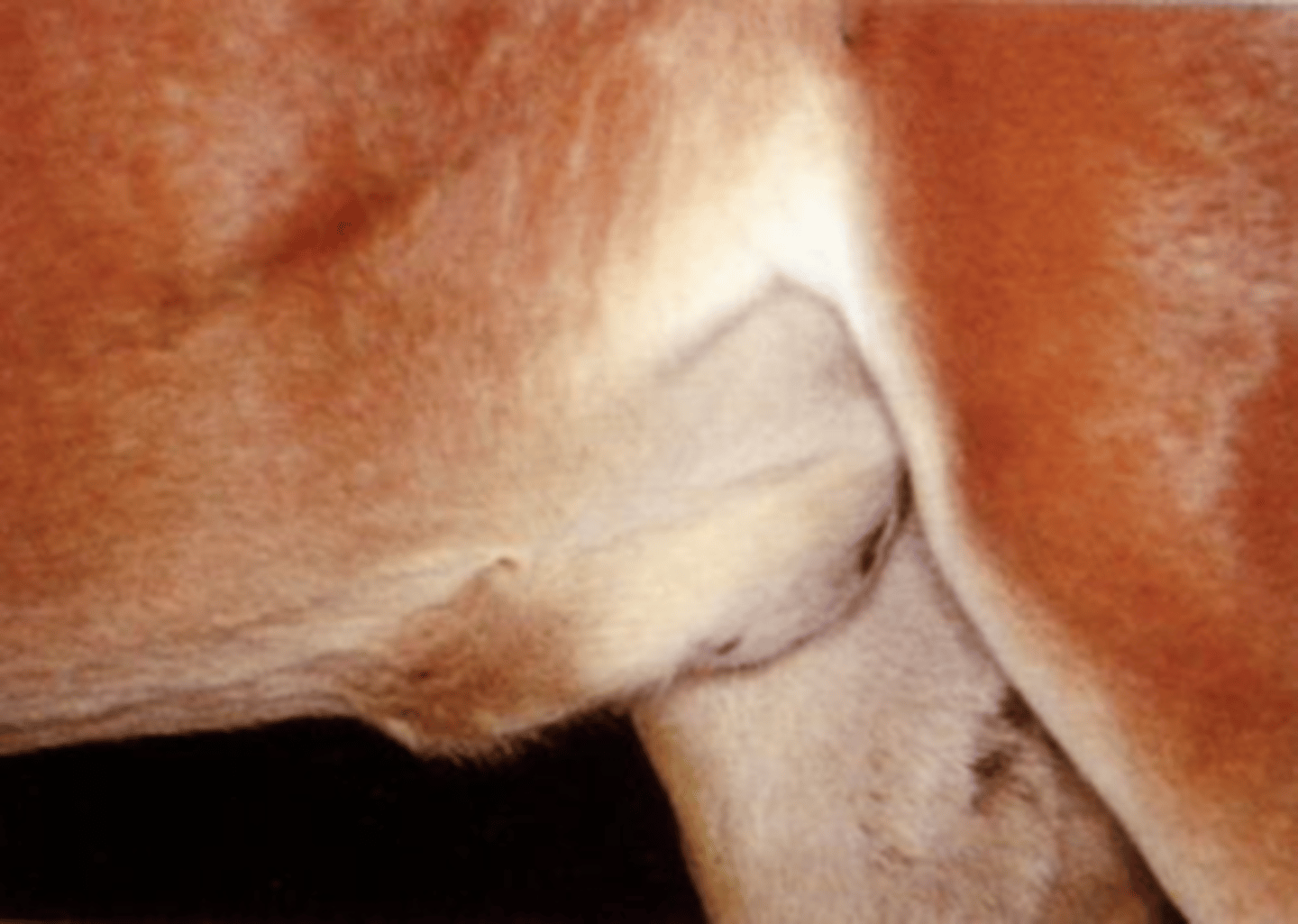 <p>- Defect in the umbilical wall (allowing for a hernia to occur due to a failure of closure of the umbilical ring)</p><p>- Infection of umbilical structures</p><p>- Persistent urachus</p>