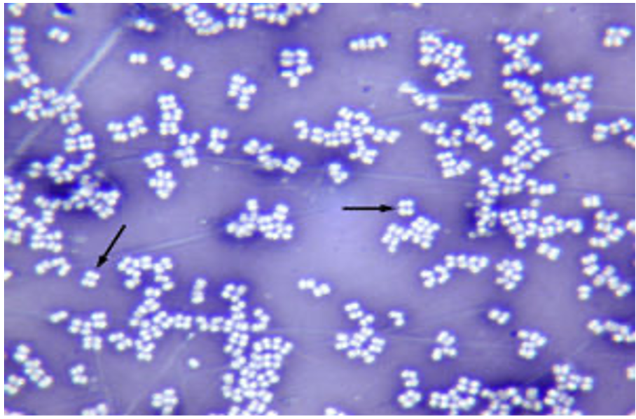 Micrococcus luteus (negative stain) 