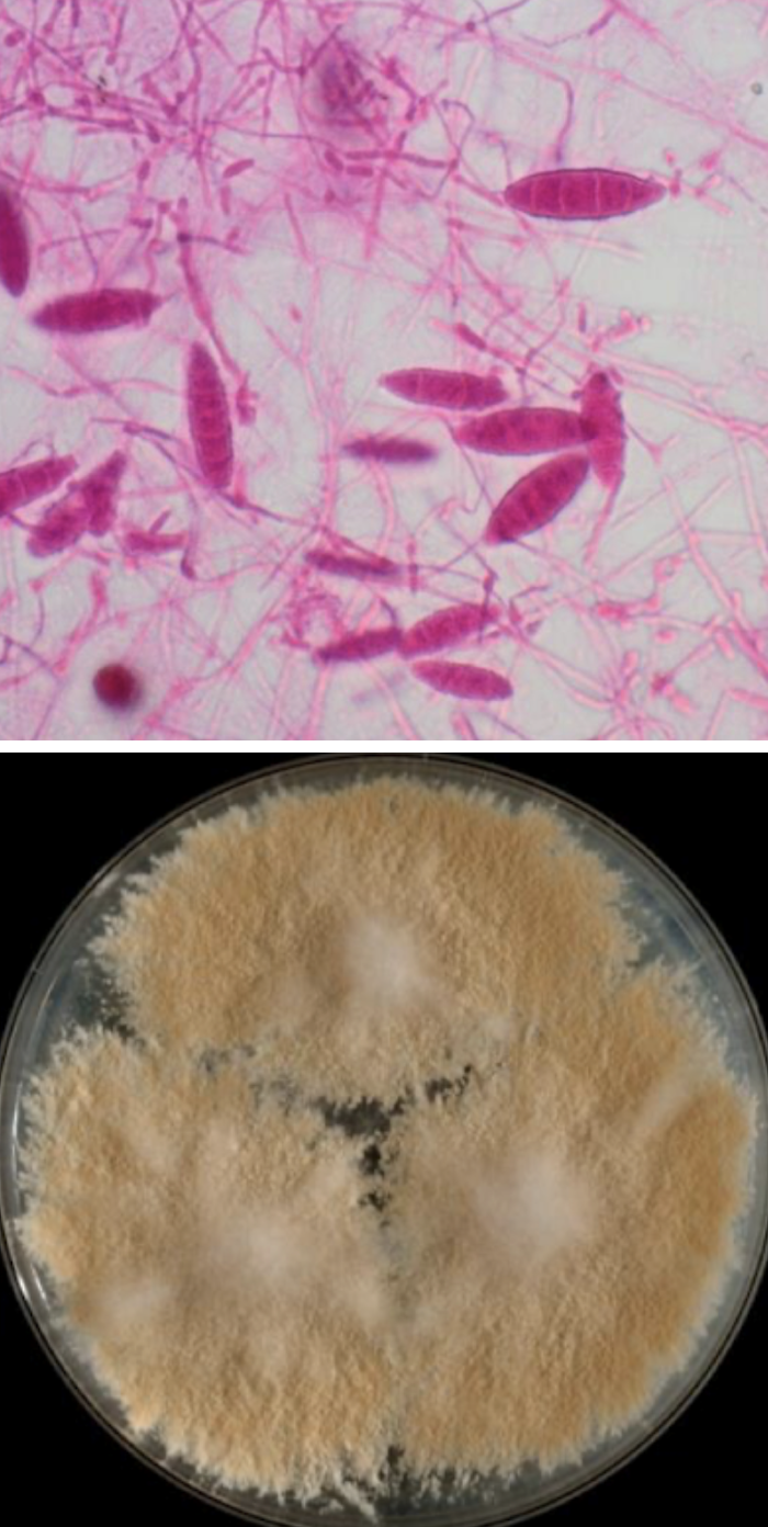 <p>Microsporum gypseum</p>