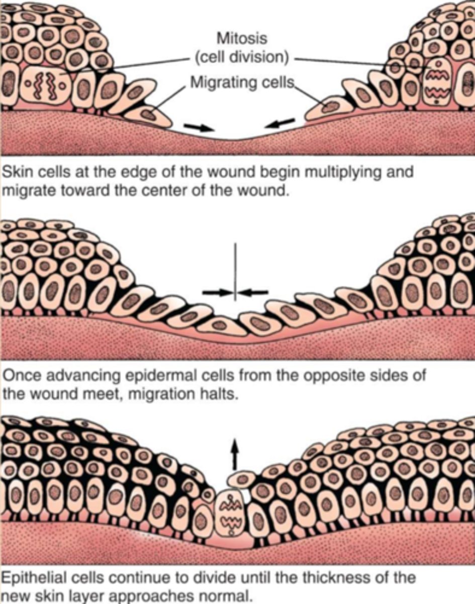 <p>The sides grow towards the middle like a volcano</p>