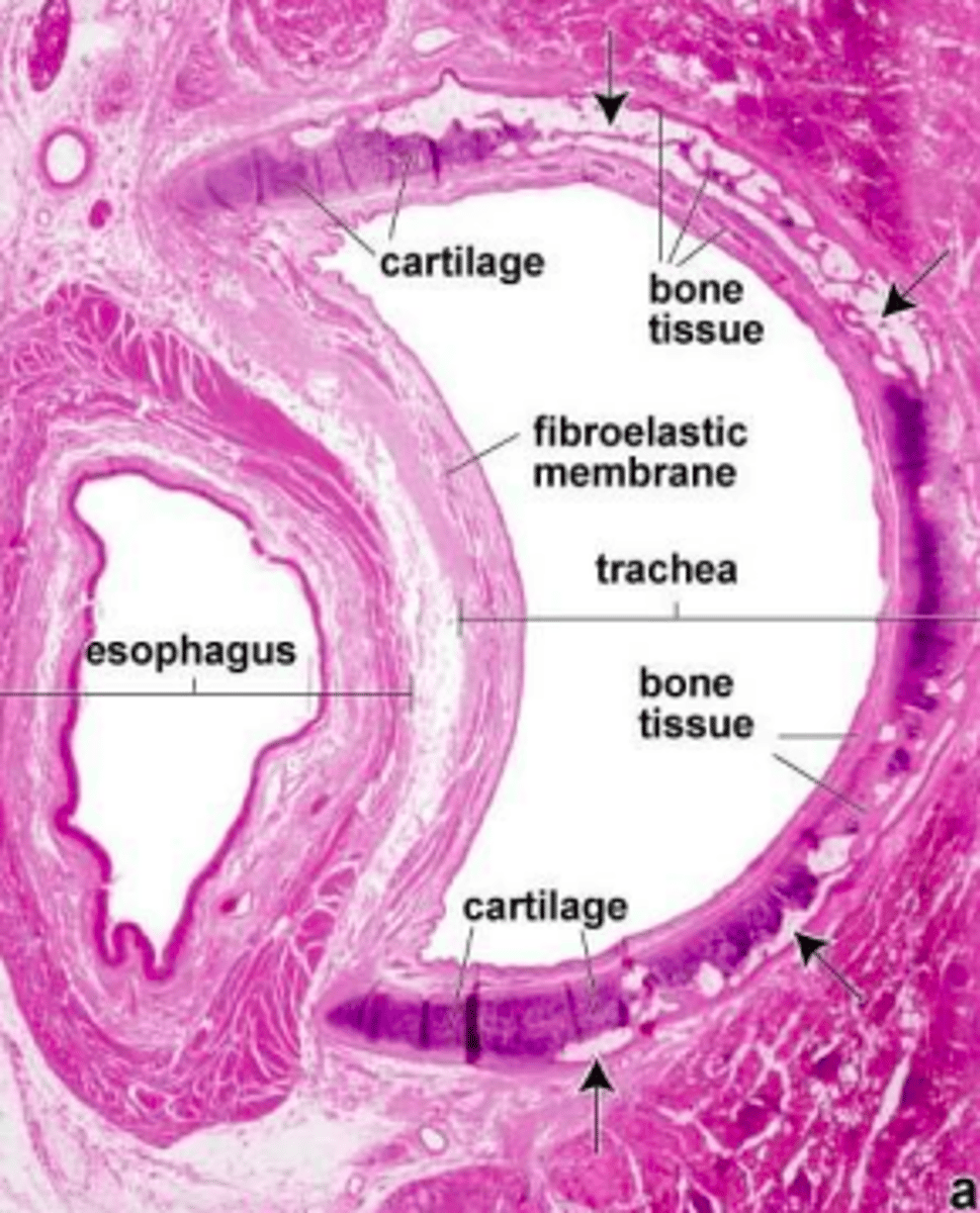 <p>trachealis muscle</p>