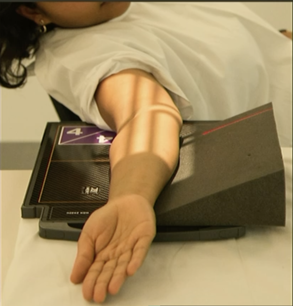 <p>Fine FS, 100cm</p><p>57kVp/2.5mAs</p><p>Straight tube</p><p>CR: Cubital fossa</p>