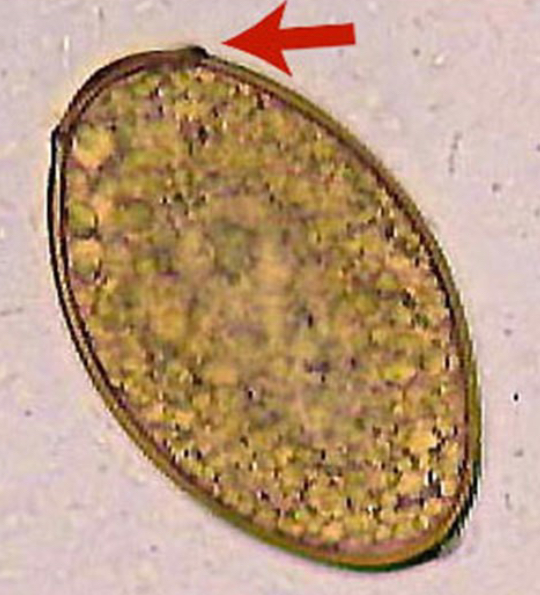 <p>Fecal sedimentation or centrifugation with sheather’s</p>