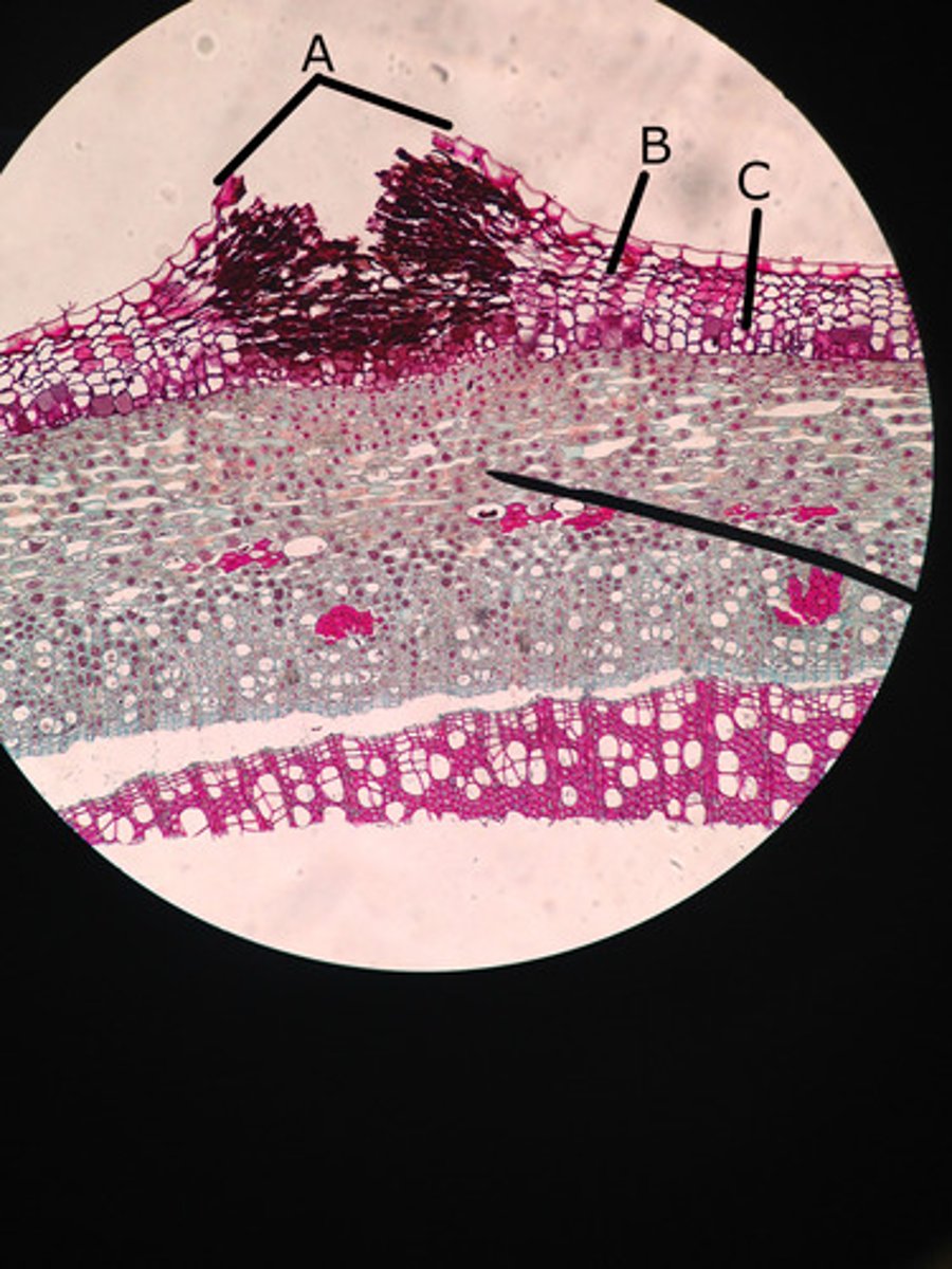 <p>ruptures (raised openings) in the periderm/cork cells (outer bark) that enables gas exchange</p><p>(A in pic)</p>
