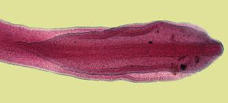 <p>in human</p><p>anemia, intestinal obstruction, bile duct inflammation, or asymptomatic</p><p>history of eating raw fish</p><p>worldwide (endemic in Scandanavia, Baltic area, Russia, America)</p>