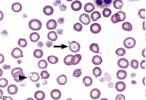 <p>what type of RBC abnormality is this</p>