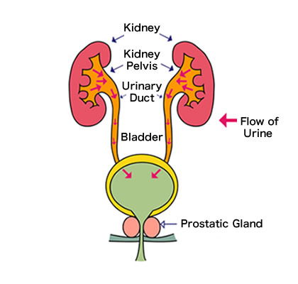 <p>-acute, interstitial, intrarenal</p><p>-infective</p><p>-in blood or upward from bladder</p><p>-white blood cell casts</p><p></p>