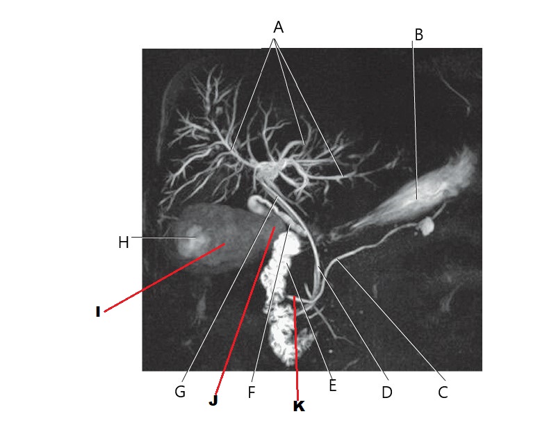 <p>Which arrow pointing on main pancreatic duct?</p>