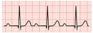 <p>What rhythm is this?</p>