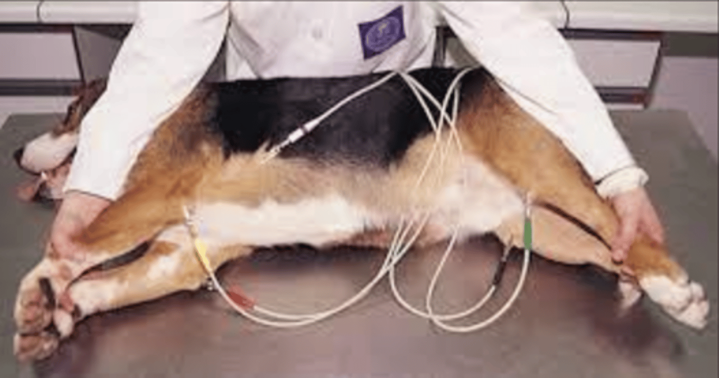 <p>what is being performed?</p>