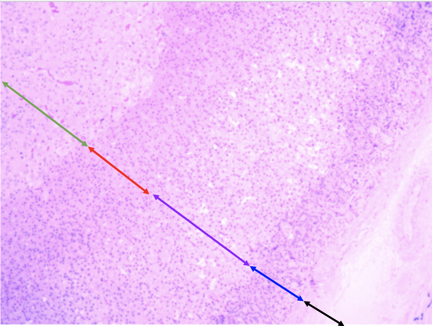 What does the green arrow indicate?