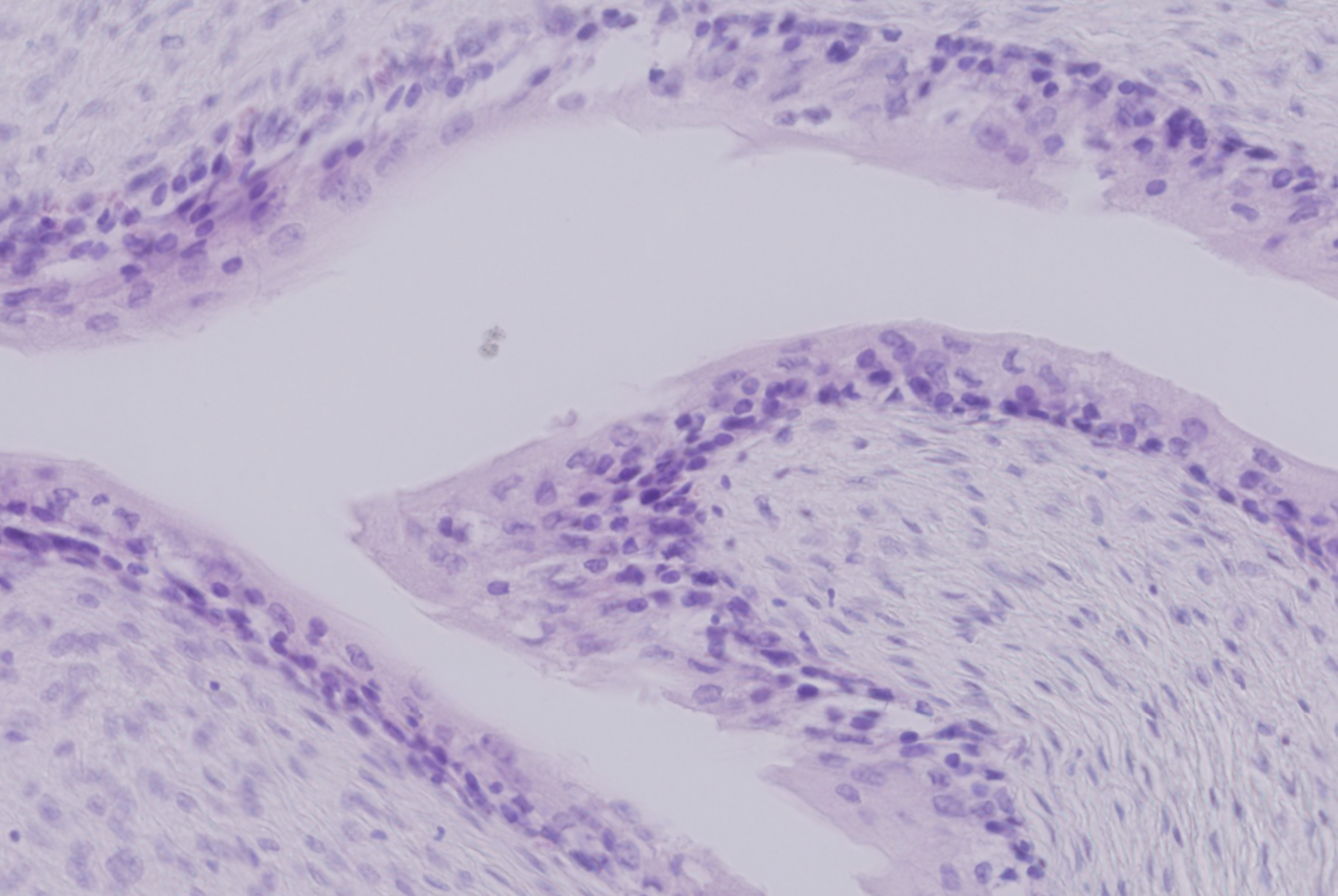 <p>Angiv urinblærens epitheltype</p>