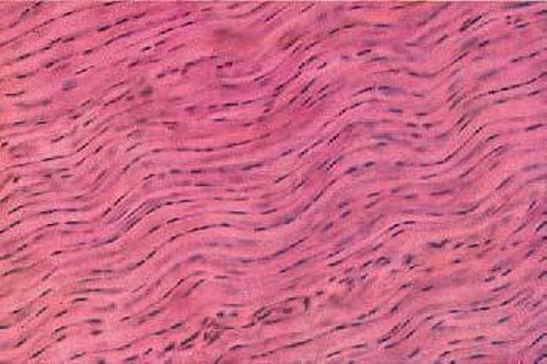 <p>Dense Regular Connective Tissue — Description</p>