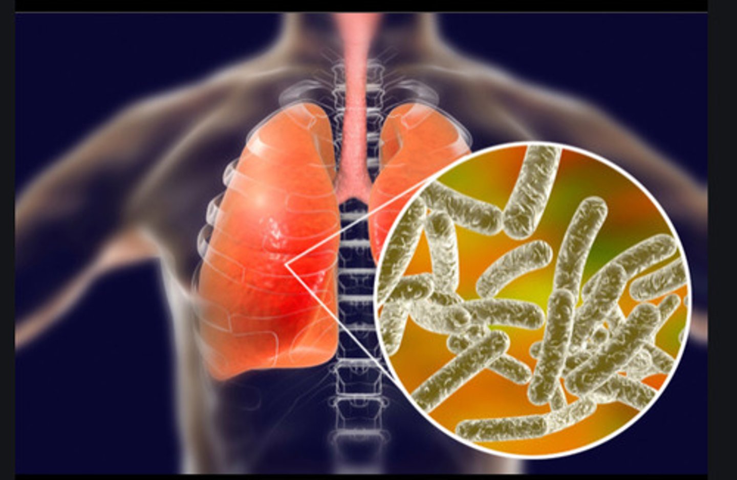 <p>Genus of bacteria responsible for the disease legionellosis</p>