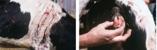 <p><span>Vit K Deficiency</span></p>