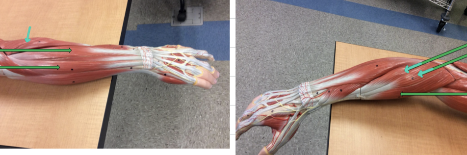 <p>Identify this muscle?</p>