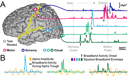 <p>Machine designed to record the brain wave patterns produced by electrical activity of the surface of the brain. </p><ul><li><p>Usually used to diagnose sleep issues.</p></li></ul>