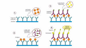 <ul><li><p>Antibody test</p></li><li><p>Quantitive and Qualitative </p></li></ul><ol><li><p>Antibodies are spread onto a micro titer plate, and antigen is added</p></li><li><p>Then a labeled antibody is added and will bind to the antigen if present</p></li><li><p>A substrate is added and will cause a color reaction if antigen is present </p></li></ol><p></p>