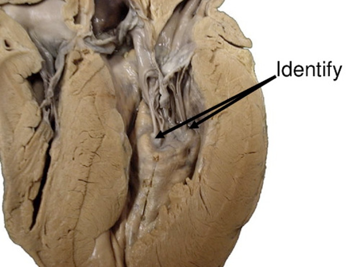 <p>prevent prolapse of AV valves</p>